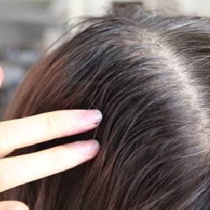 女性の薄毛は食べるもので予防をしよう