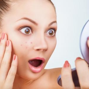 あっさり消滅!ニキビ肌や凸凹肌の女子が大絶賛した薬用ジェル♡