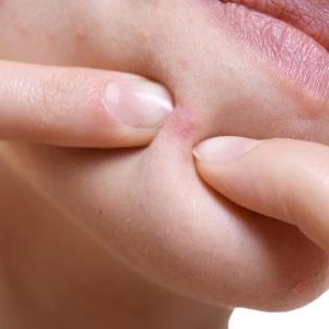 ニキビを目立たなくさせる身近なもので出来るおすすめの方法とは