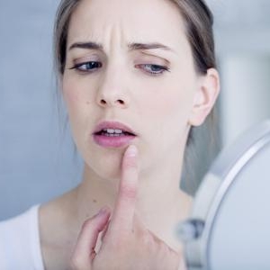 口元にできてしまったニキビは正しいケアで改善!
